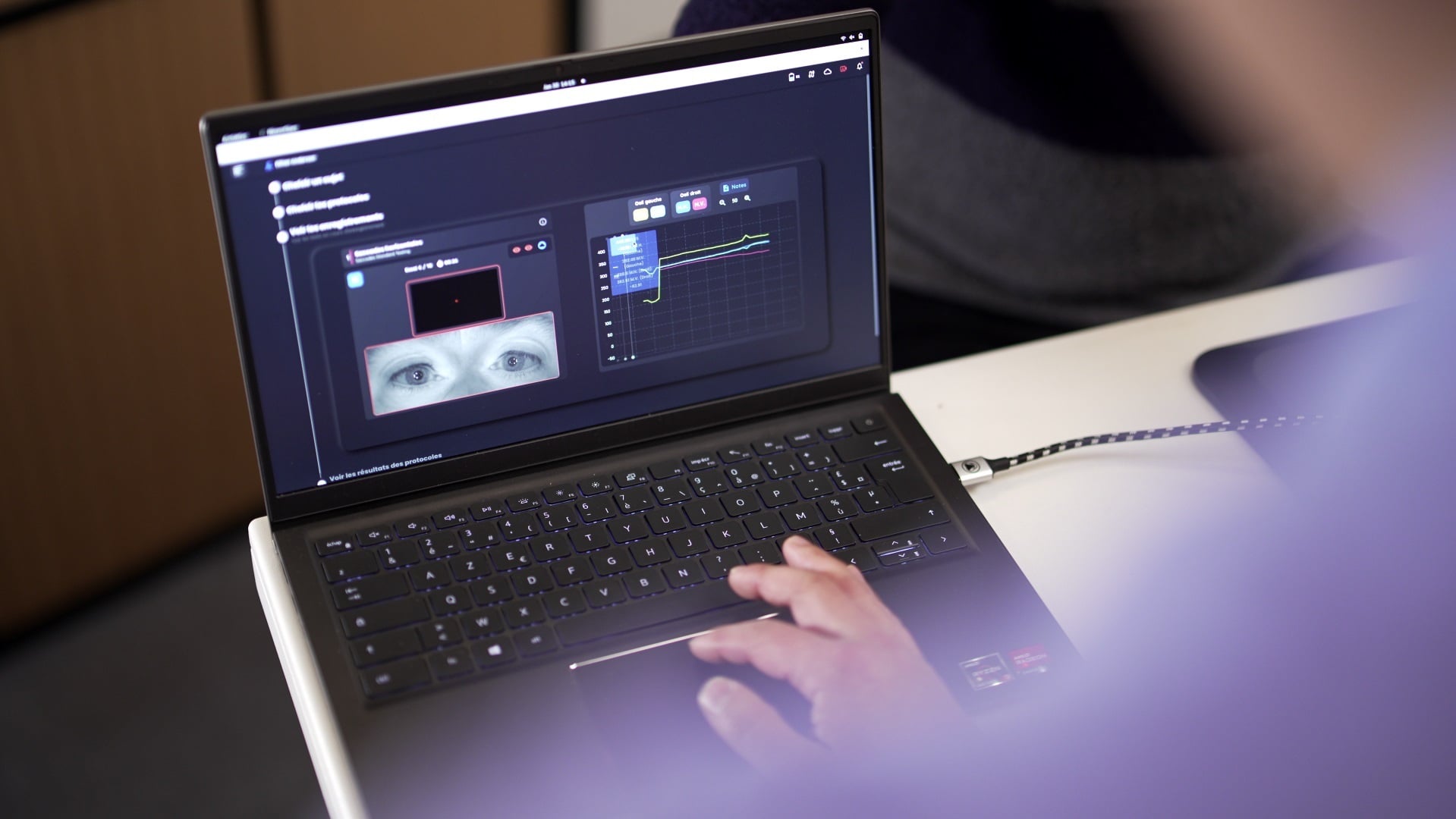 eyetracking clinical study 
